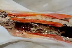 Ligamento de la articulación de las valvas.