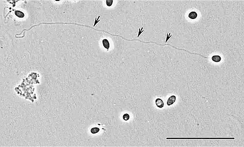 Tubo Polar extendido (flechas) ~140 μm. Brachiola algerae/Anncaliia algerae.