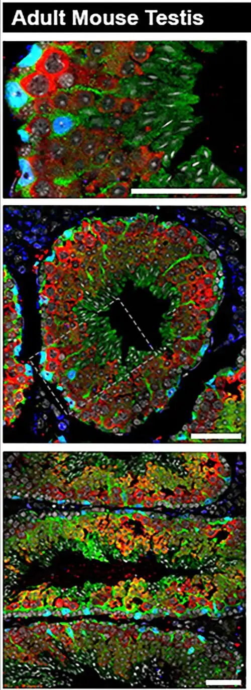Túbulos en corte longitudinal. Epitelio seminífero. Inmunohistoquímica. Microscopio confocal.