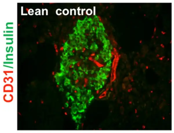 Arteriola y capilares (en rojo). En la periferia del islote (a la derecha en rojo), una arteriola seccionada horizontalmente, mostrando ambas paredes y la luz arteriolar. Capilares intra-islote seccionados de forma transversal. Las células endócrinas de insulina se ven en verde. Inmunohistoquímica. Microscopio confocal.